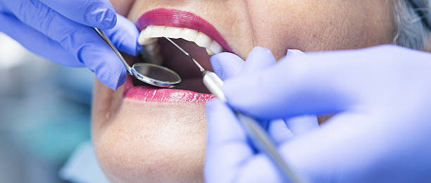 Best Emergency Dentist for Lost Fillings or Crowns in Gallatin, MO
